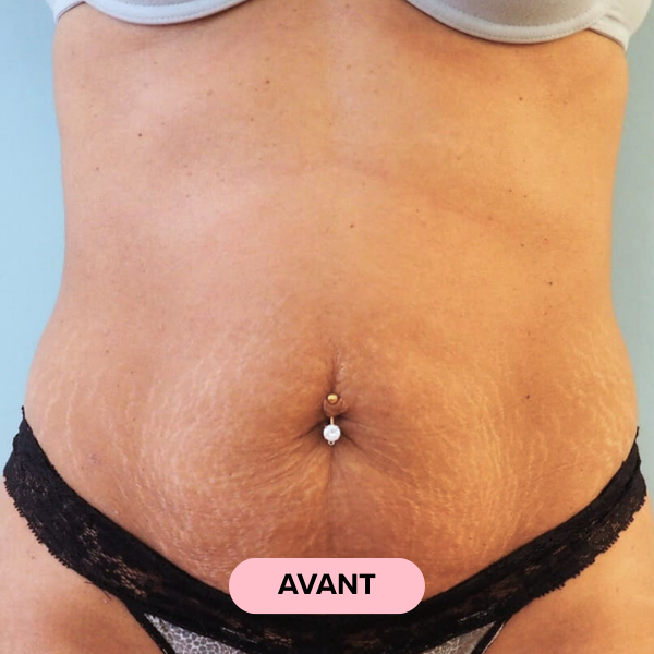 Before using product